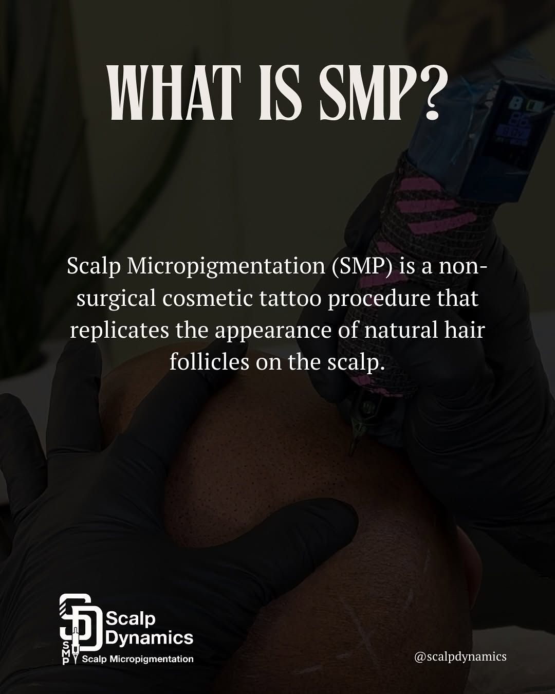 SMP procedure
